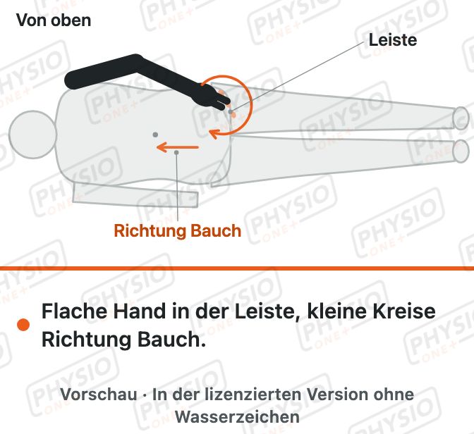 Vorschau: Selbstbehandlung an der Leiste