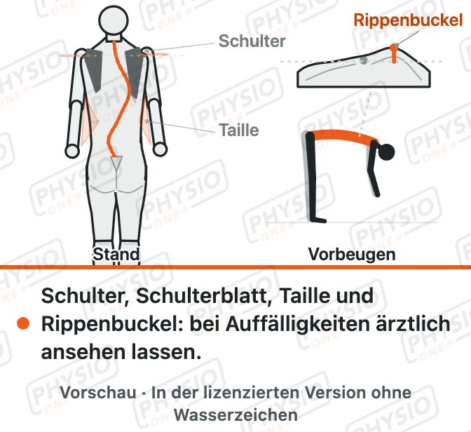 Vorschau: Skoliose bei Jugendlichen erkennen