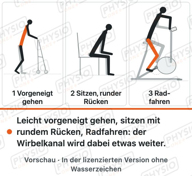 Vorschau: Entlastende Haltungen bei Spinalkanalstenose