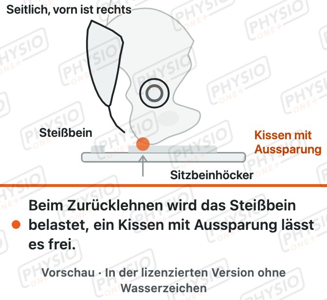 Vorschau: Schmerz am Steißbein