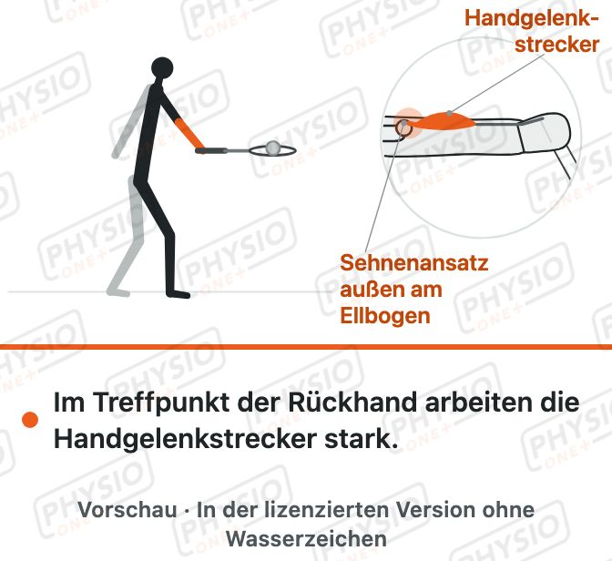 Vorschau: Tennisarm und Schlägersport