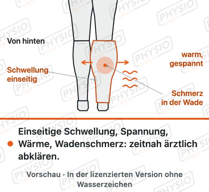 Vorschau: Thrombose: Warnzeichen erkennen