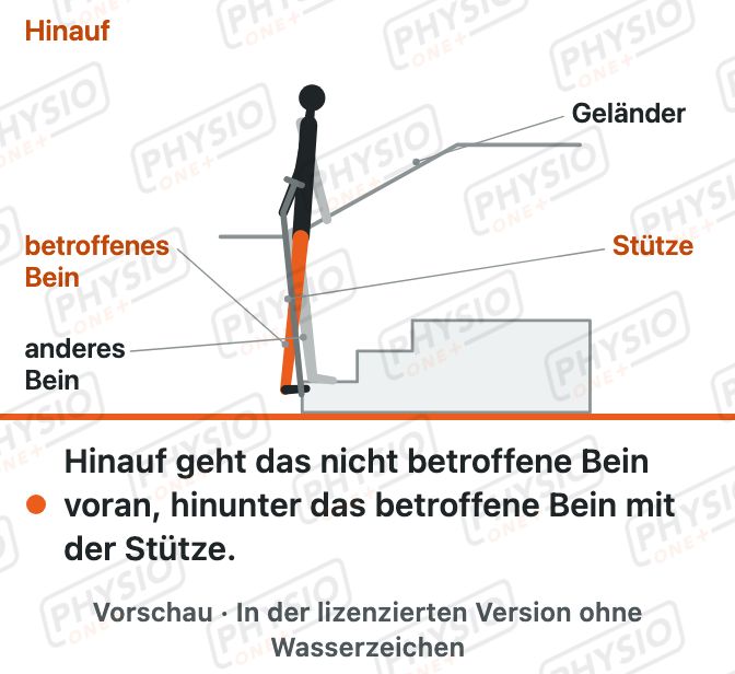 Vorschau: Treppensteigen mit Unterarmstützen