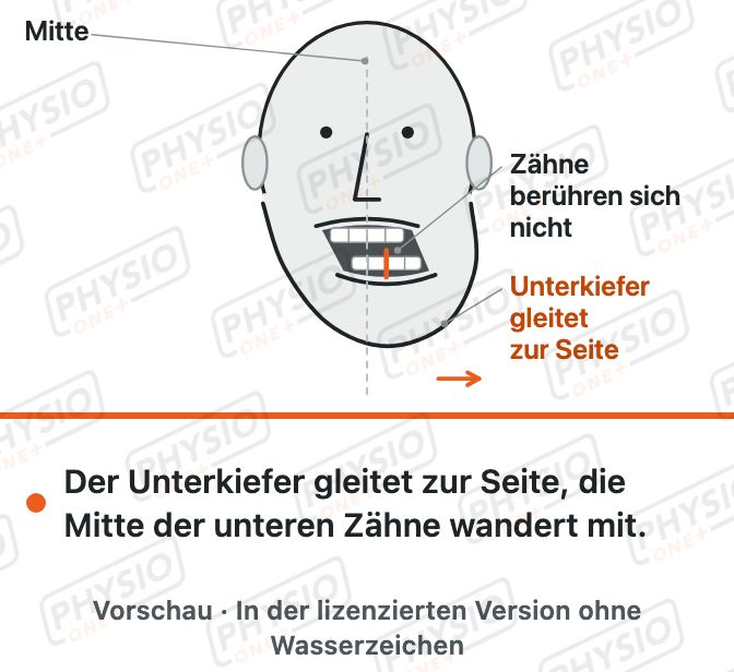 Vorschau: Unterkiefer seitlich verschieben