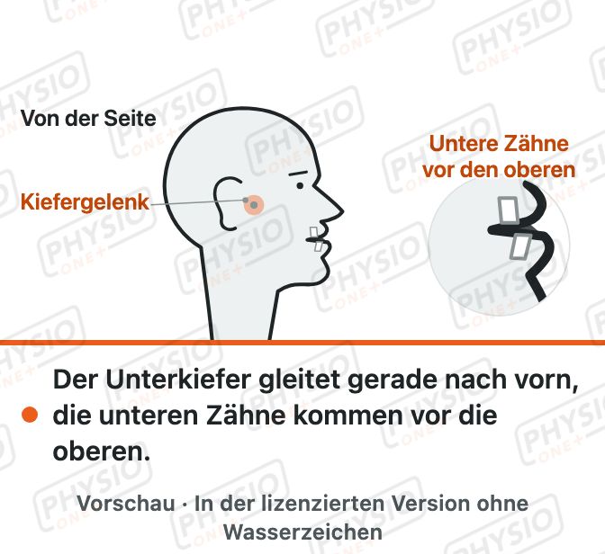 Vorschau: Unterkiefer gerade vorschieben