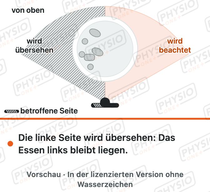 Vorschau: Vernachlässigte Körperseite