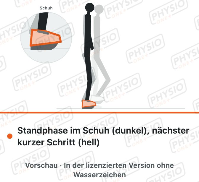 Vorschau: Gehen im Vorfußentlastungsschuh