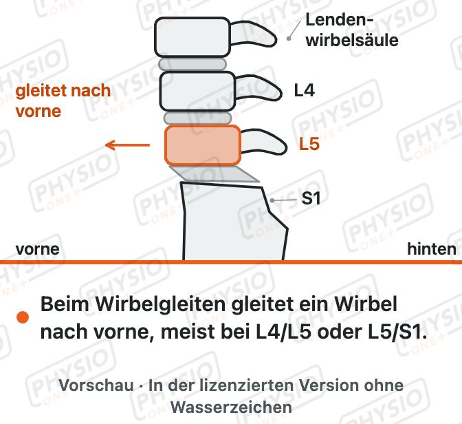 Vorschau: Wirbelgleiten