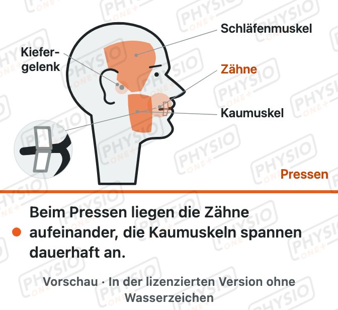 Vorschau: Zähne pressen und knirschen